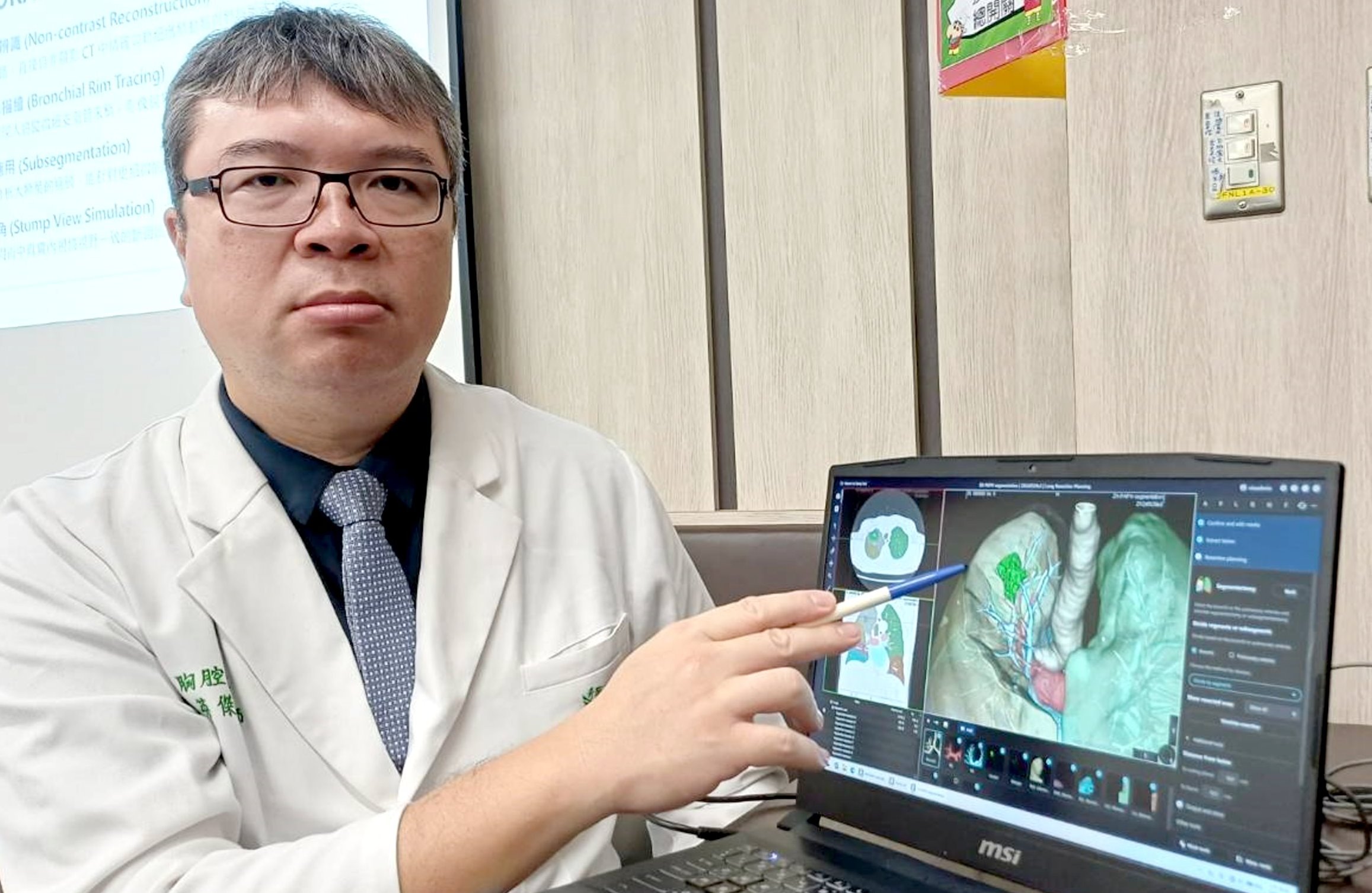 65歲男子0.9公分肺結節 怕打顯影劑！AI輔助3D影像重組助精準切肺